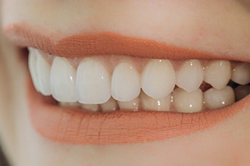 Closeup of woman smiling with veneers in Plano