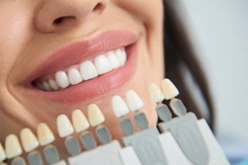 Closeup of dentist shade-matching smiling patient's white teeth