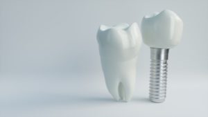 dental implant in Plano next to natural tooth 